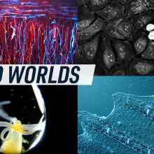 A collage shows different cells and organisms under a microscope. Caption reads "Micro worlds'